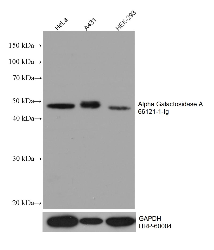Western Blot (WB) analysis of various lysates using Alpha Galactosidase A Monoclonal antibody (66121-1-Ig)