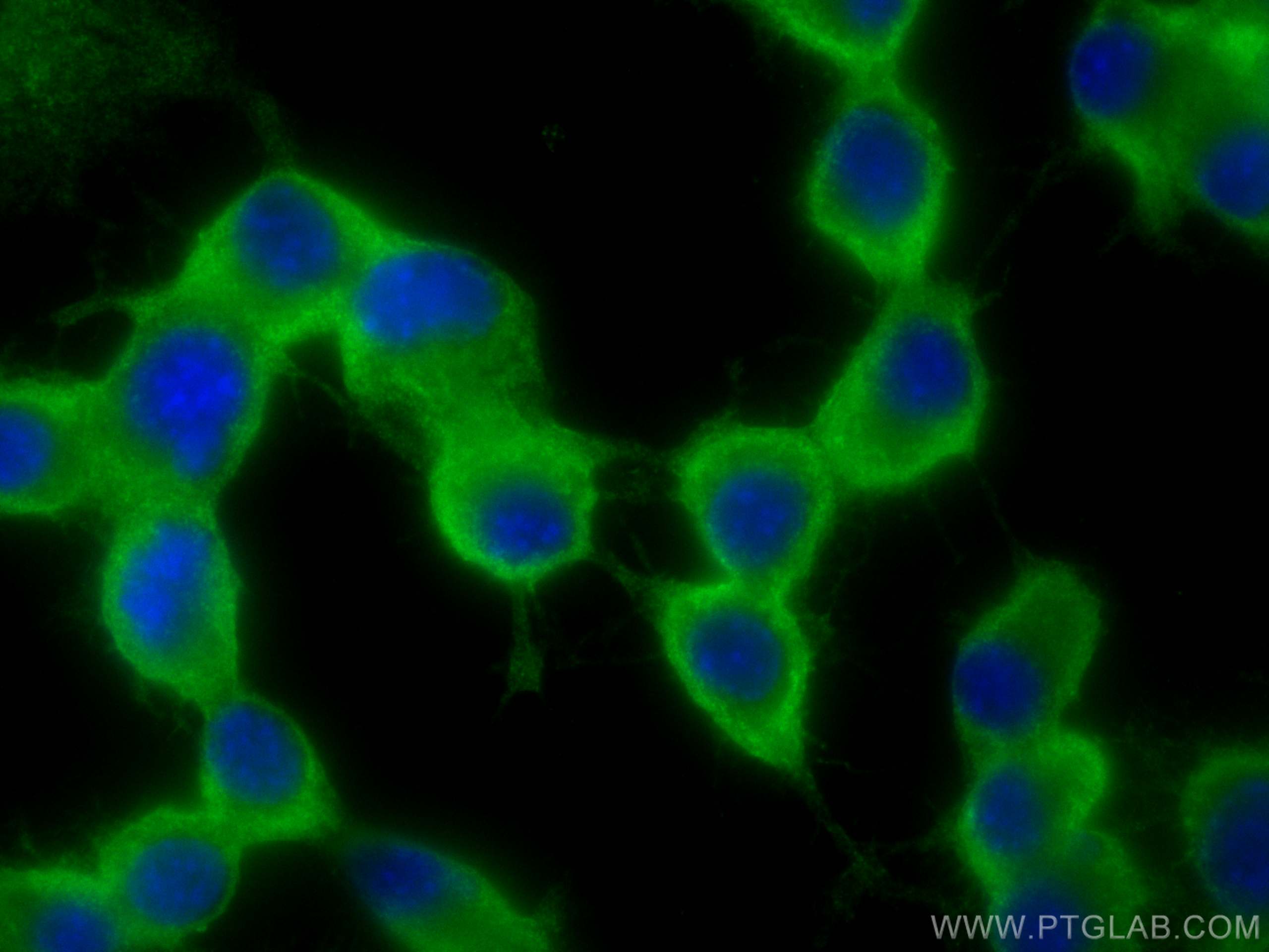 Immunofluorescence (IF) / fluorescent staining of Neuro-2a cells using GLAST Polyclonal antibody (20785-1-AP)