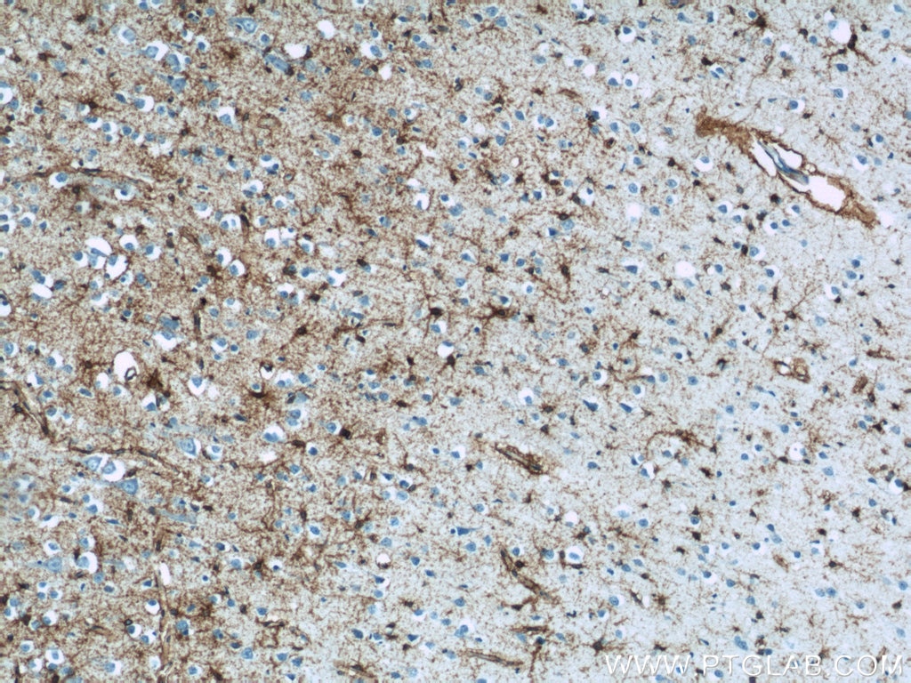 Immunohistochemistry (IHC) staining of human brain tissue using GLAST Polyclonal antibody (20785-1-AP)