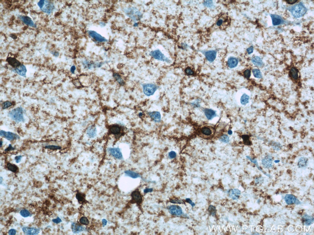 Immunohistochemistry (IHC) staining of human brain tissue using GLAST Polyclonal antibody (20785-1-AP)