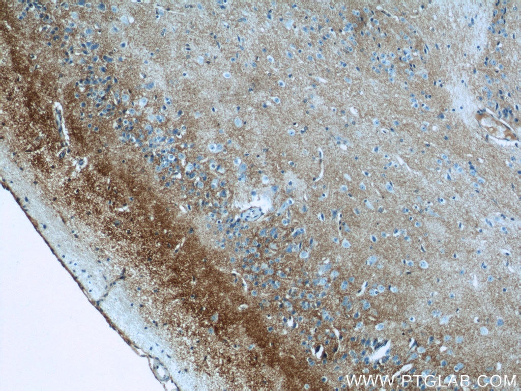 Immunohistochemistry (IHC) staining of mouse brain tissue using GLAST Polyclonal antibody (20785-1-AP)