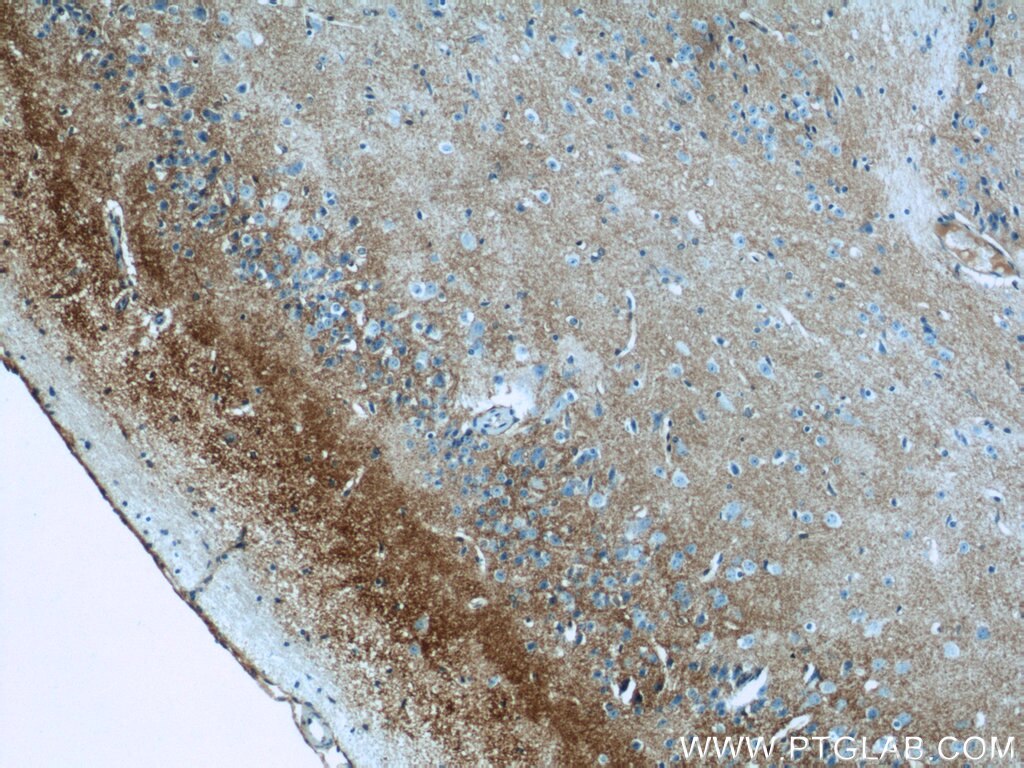 IHC staining of mouse brain using 20785-1-AP