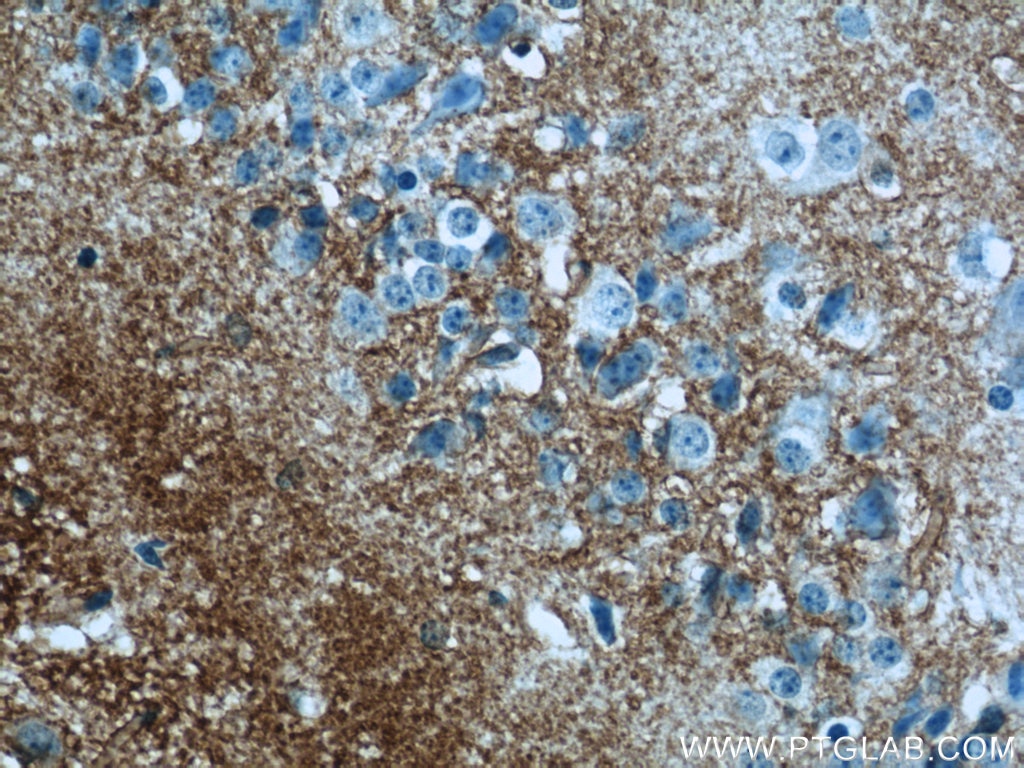 Immunohistochemistry (IHC) staining of mouse brain tissue using GLAST Polyclonal antibody (20785-1-AP)