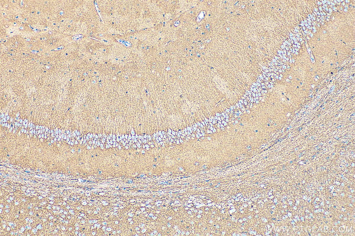 Immunohistochemistry (IHC) staining of mouse brain tissue using GLAST/EAAT1 Polyclonal antibody (20785-1-AP)