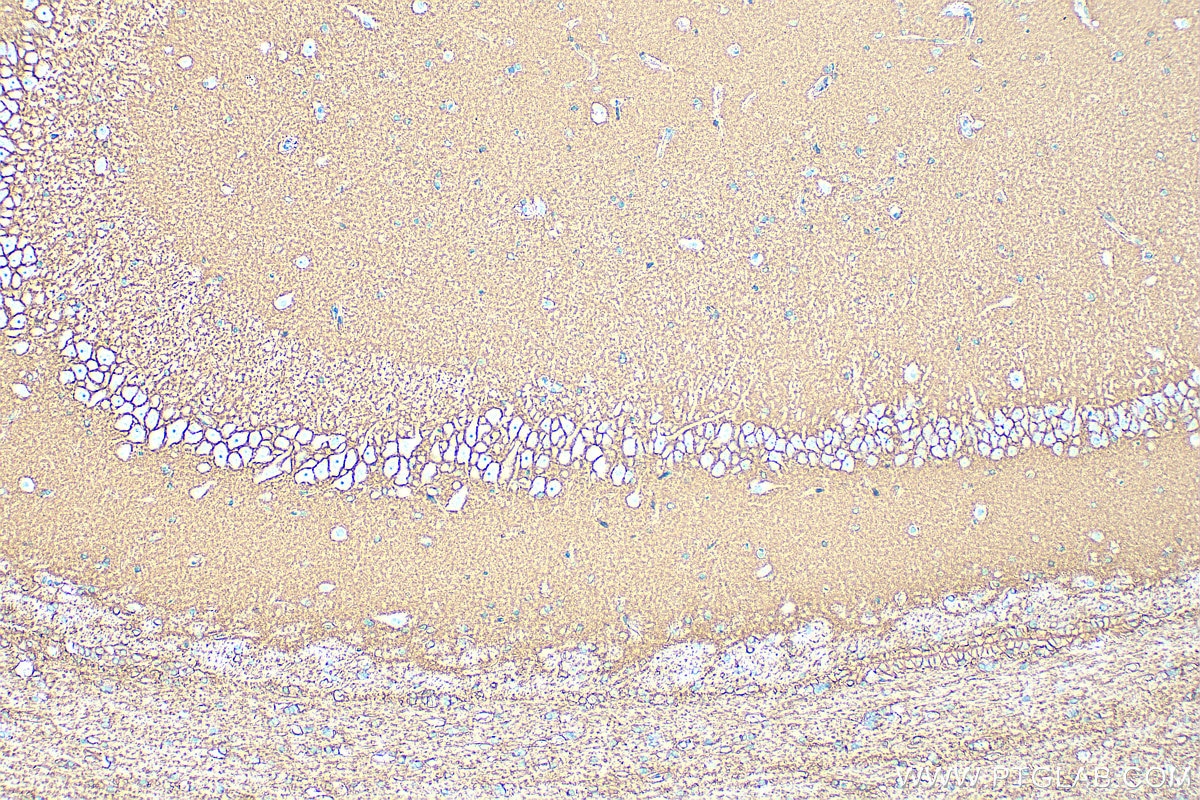 Immunohistochemistry (IHC) staining of rat brain tissue using GLAST/EAAT1 Polyclonal antibody (20785-1-AP)