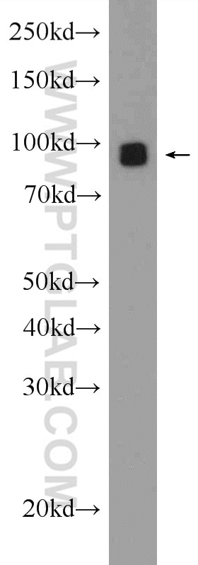 Western Blot (WB) analysis of Neuro-2a cells using GLAST Polyclonal antibody (20785-1-AP)