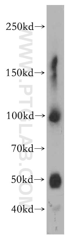 Western Blot (WB) analysis of mouse brain tissue using GLAST Polyclonal antibody (20785-1-AP)