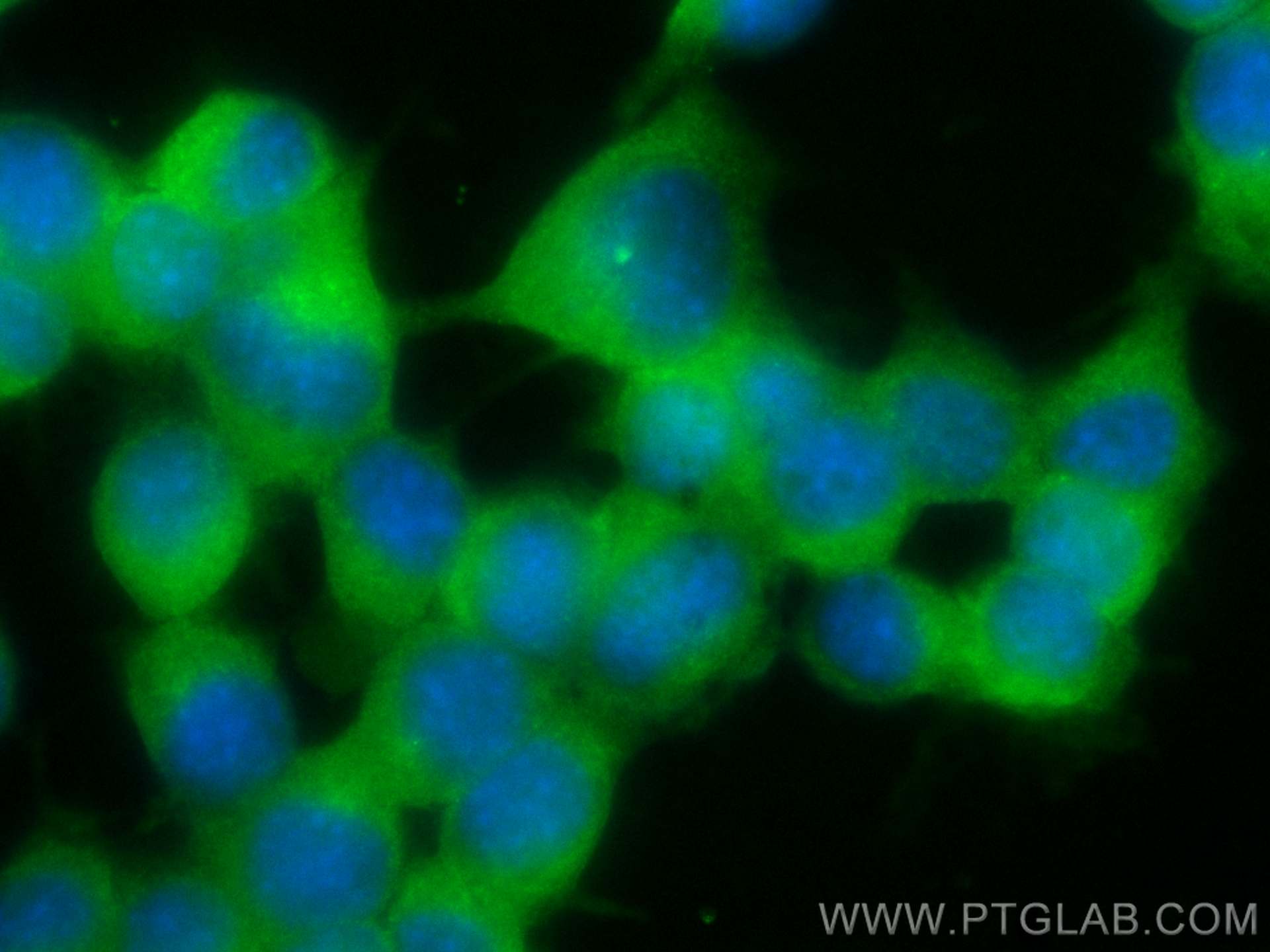 Immunofluorescence (IF) / fluorescent staining of Neuro-2a cells using CoraLite® Plus 488-conjugated GLAST Polyclonal ant (CL488-20785)