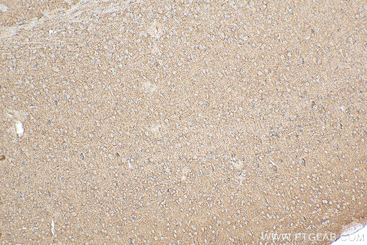 Immunohistochemical analysis of paraffin-embedded mouse brain tissue slide using Biotin-20785 (GLAST/EAAT1 antibody) at dilution of 1:200 (under 10x lens). Heat mediated antigen retrieval with Tris-EDTA buffer (pH 9.0). Immunohistochemistry (IHC) staining of mouse brain tissue using Biotin Plus-conjugated GLAST/EAAT1 Polyclonal anti (Biotin-20785)