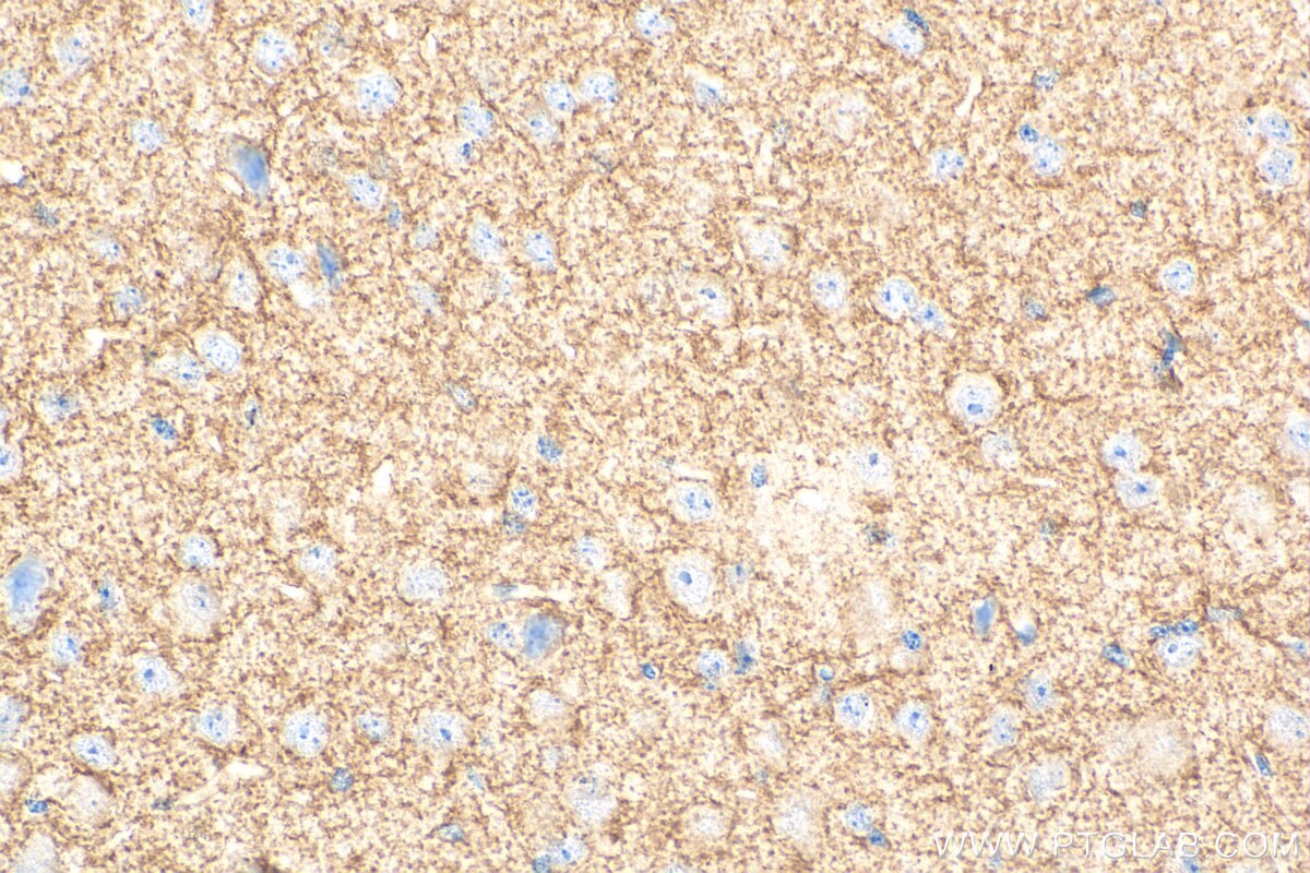 Immunohistochemical analysis of paraffin-embedded mouse brain tissue slide using Biotin-20785 (GLAST/EAAT1 antibody) at dilution of 1:200 (under 40x lens). Heat mediated antigen retrieval with Tris-EDTA buffer (pH 9.0). Immunohistochemistry (IHC) staining of mouse brain tissue using Biotin Plus-conjugated GLAST/EAAT1 Polyclonal anti (Biotin-20785)