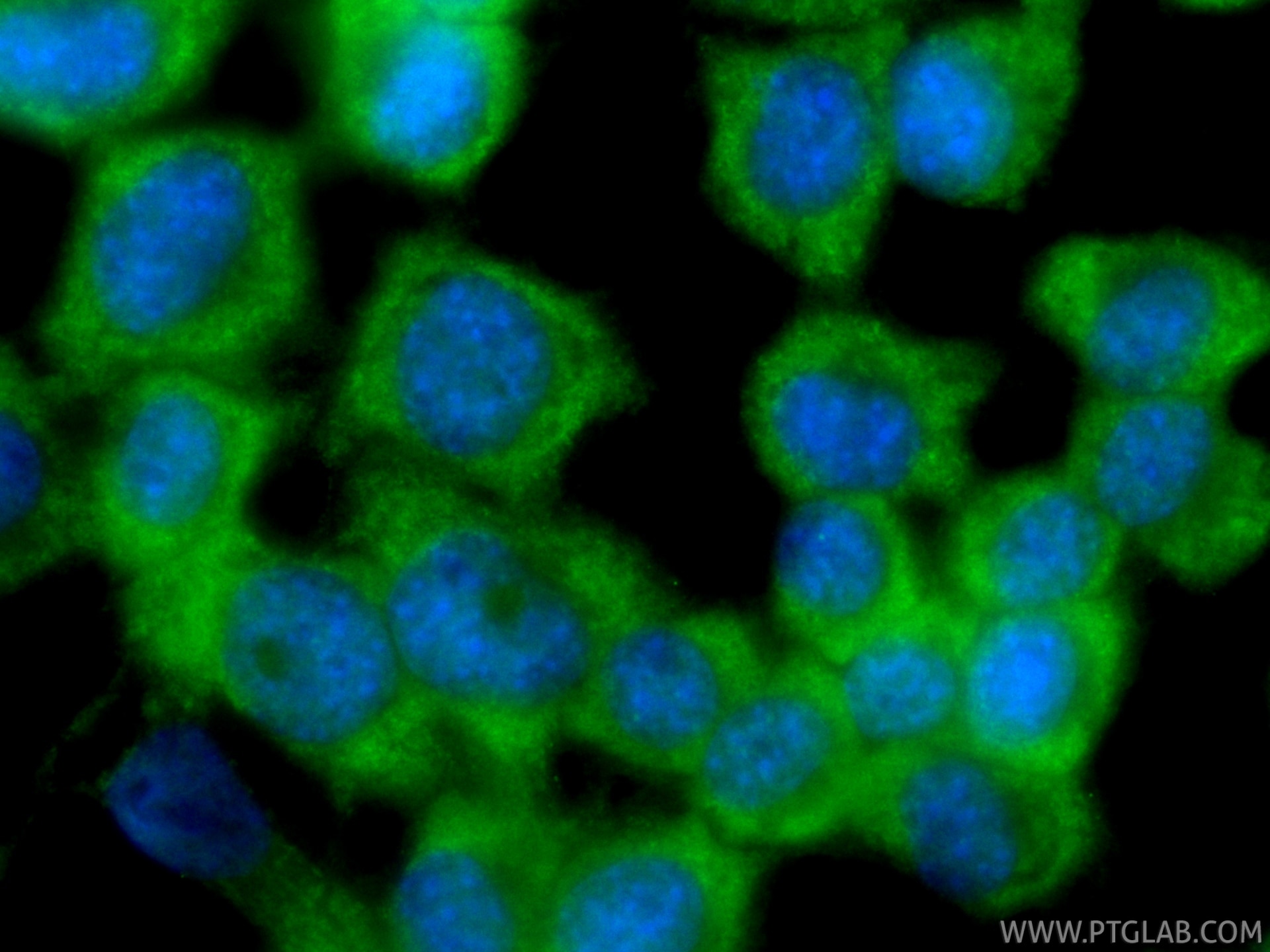 Immunofluorescence (IF) / fluorescent staining of Neuro-2a cells using CoraLite® Plus 488-conjugated GLAST/EAAT1 Recombin (CL488-84497-4)