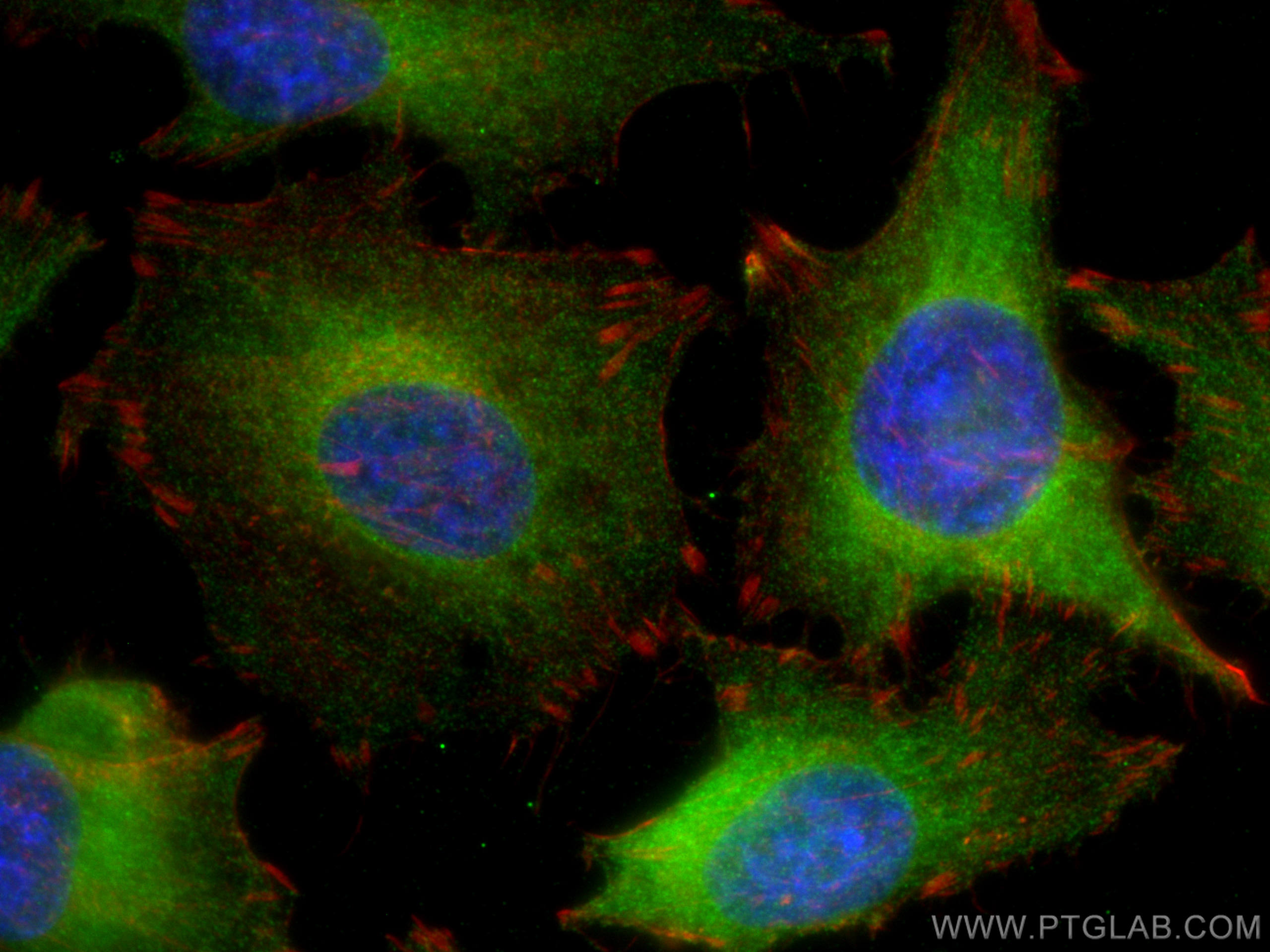 Immunofluorescence (IF) / fluorescent staining of HeLa cells using Beta Galactosidase Polyclonal antibody (15518-1-AP)