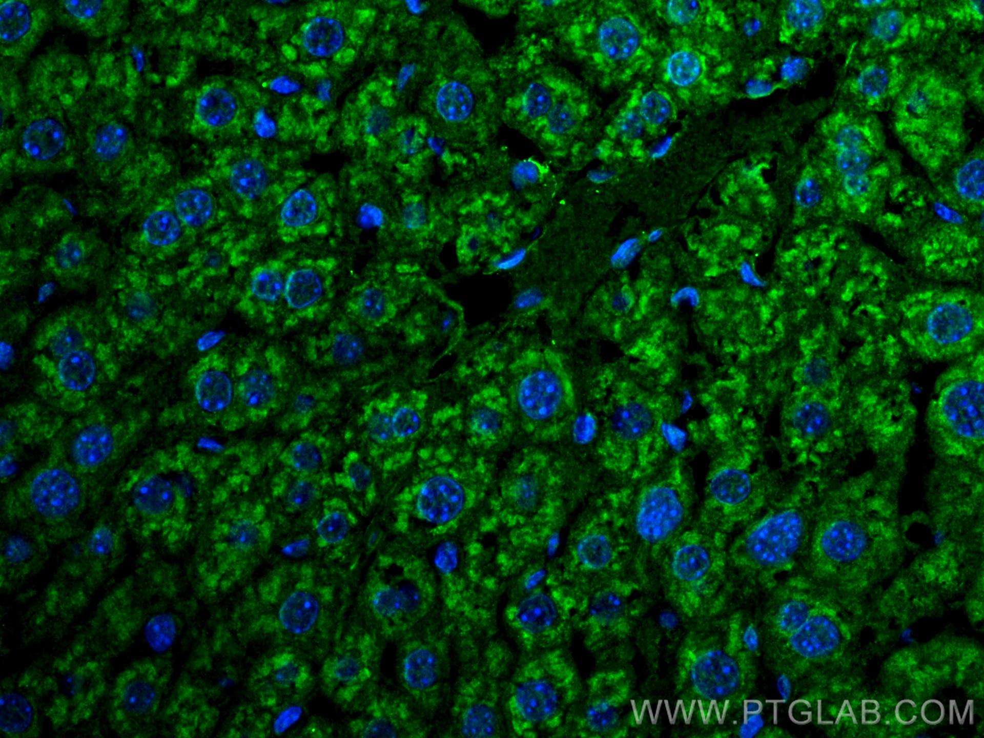 Immunofluorescence (IF) / fluorescent staining of mouse liver tissue using Beta Galactosidase Polyclonal antibody (15518-1-AP)