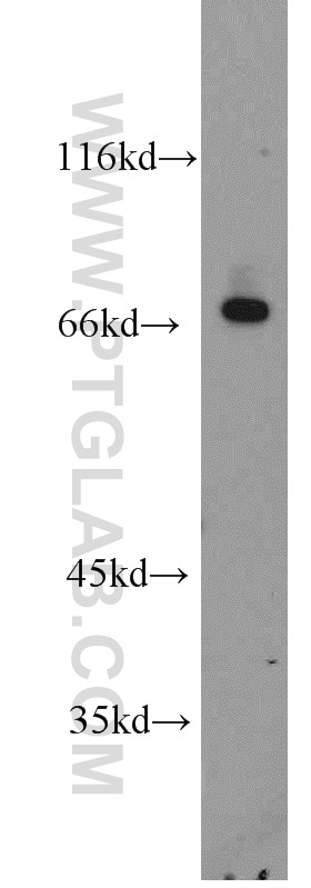 Western Blot (WB) analysis of SH-SY5Y cells using Beta Galactosidase Polyclonal antibody (15518-1-AP)