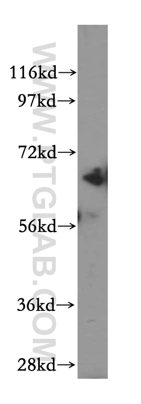 Western Blot (WB) analysis of SH-SY5Y cells using Beta Galactosidase Polyclonal antibody (15518-1-AP)