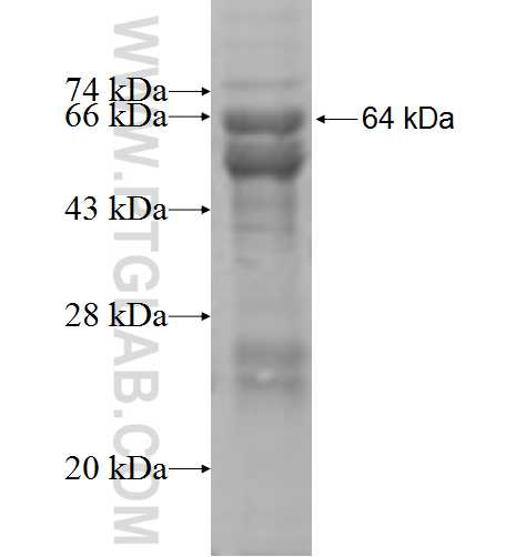 Beta galactosidase fusion protein Ag7792 SDS-PAGE