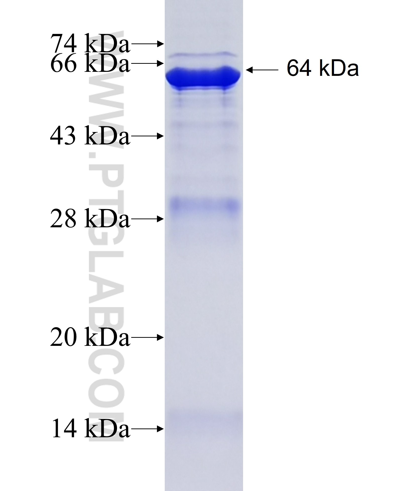 Beta galactosidase fusion protein Ag7792 SDS-PAGE