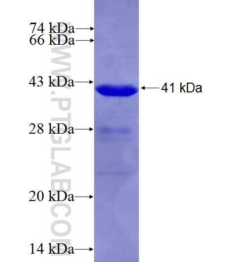 Beta galactosidase fusion protein Ag8069 SDS-PAGE