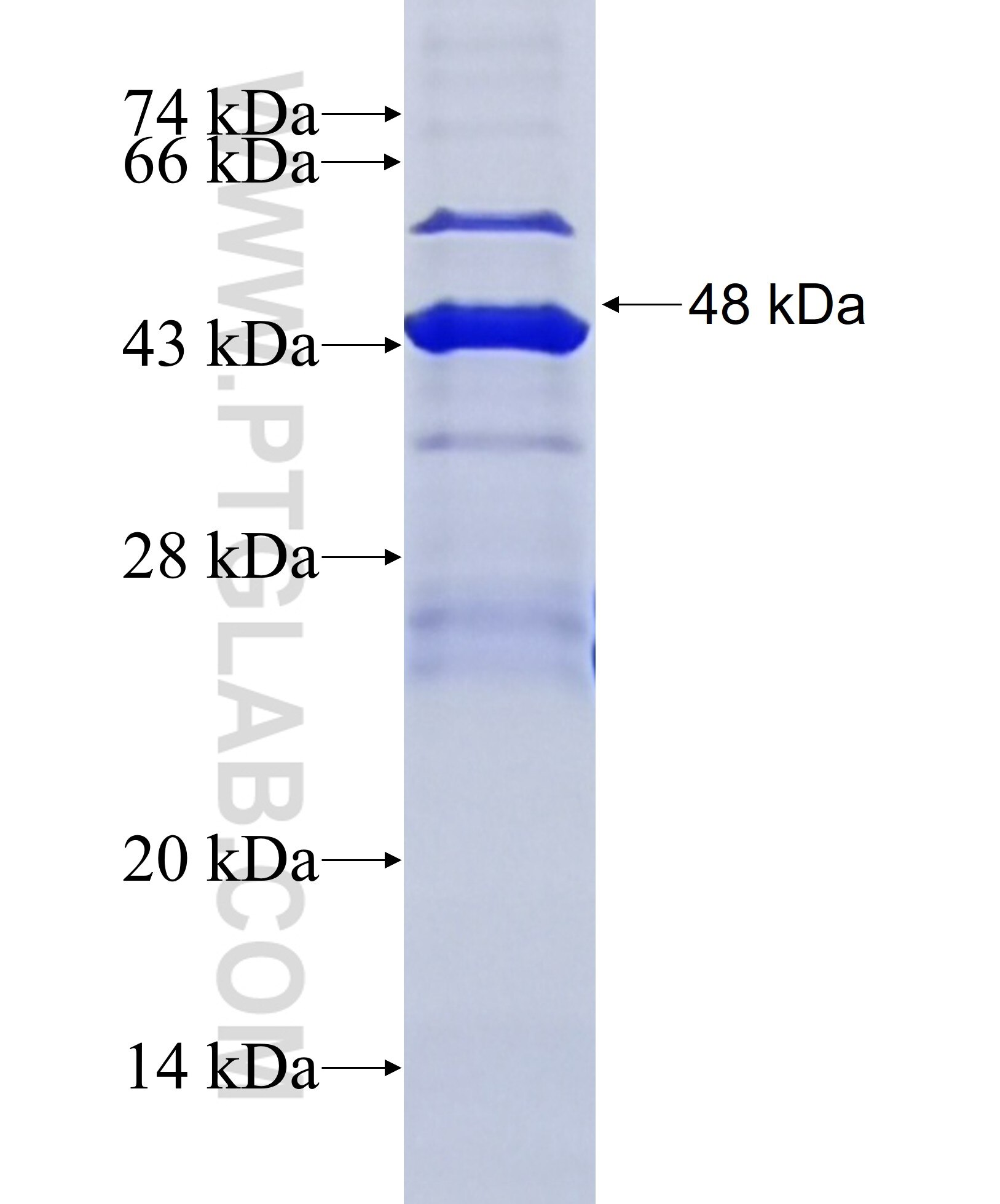 GLB1L2 fusion protein Ag36047 SDS-PAGE