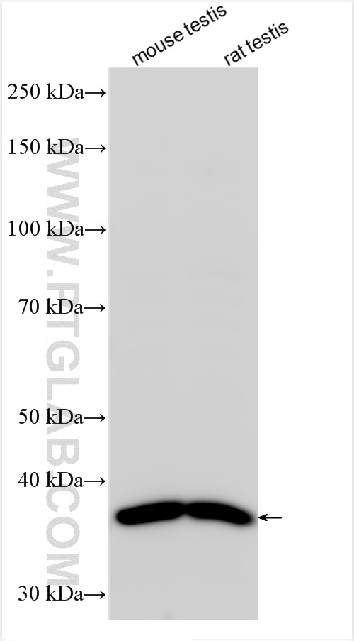 GLB1L3