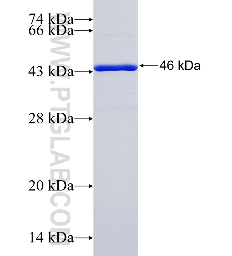 GLCCI1 fusion protein Ag35682 SDS-PAGE GLCCI1 fusion protein Ag35682 SDS-PAGE