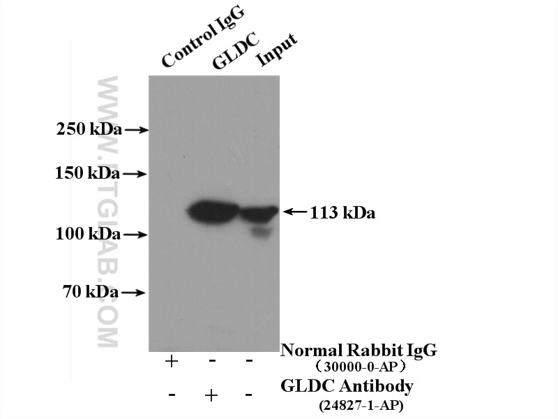 Immunoprecipitation (IP) experiment of mouse liver tissue using GLDC Polyclonal antibody (24827-1-AP)