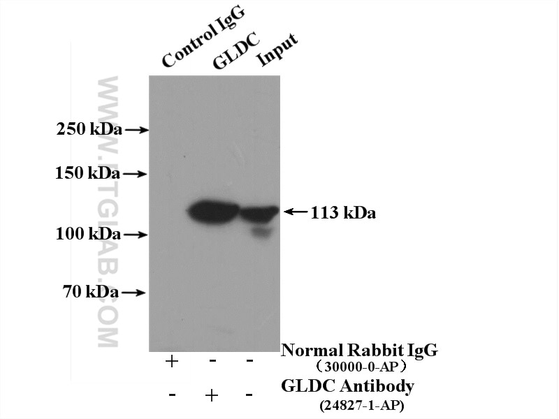 IP experiment of mouse liver using 24827-1-AP