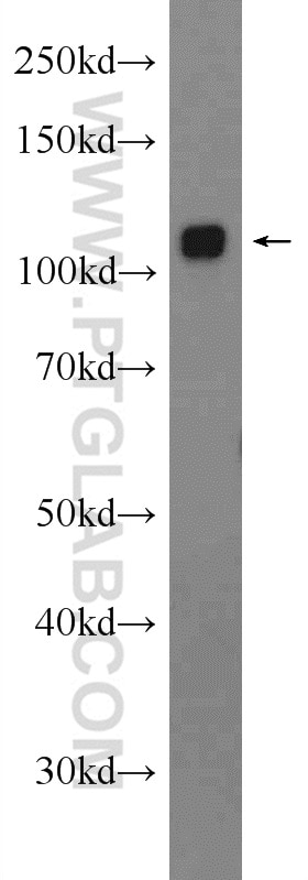 Western Blot (WB) analysis of mouse liver tissue using GLDC Polyclonal antibody (24827-1-AP)