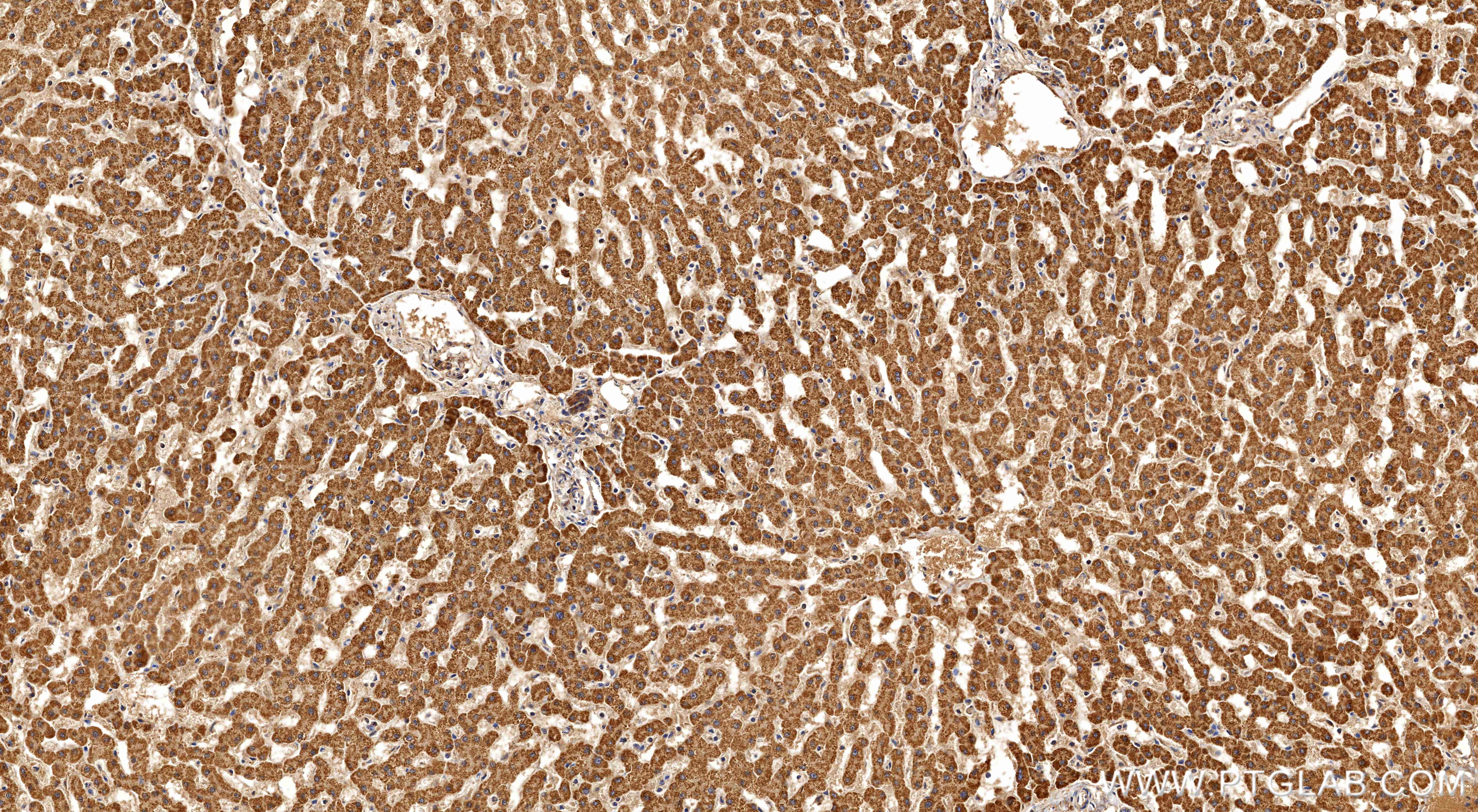 Immunohistochemistry (IHC) staining of human liver tissue using GLDC Recombinant monoclonal antibody (86378-1-RR)