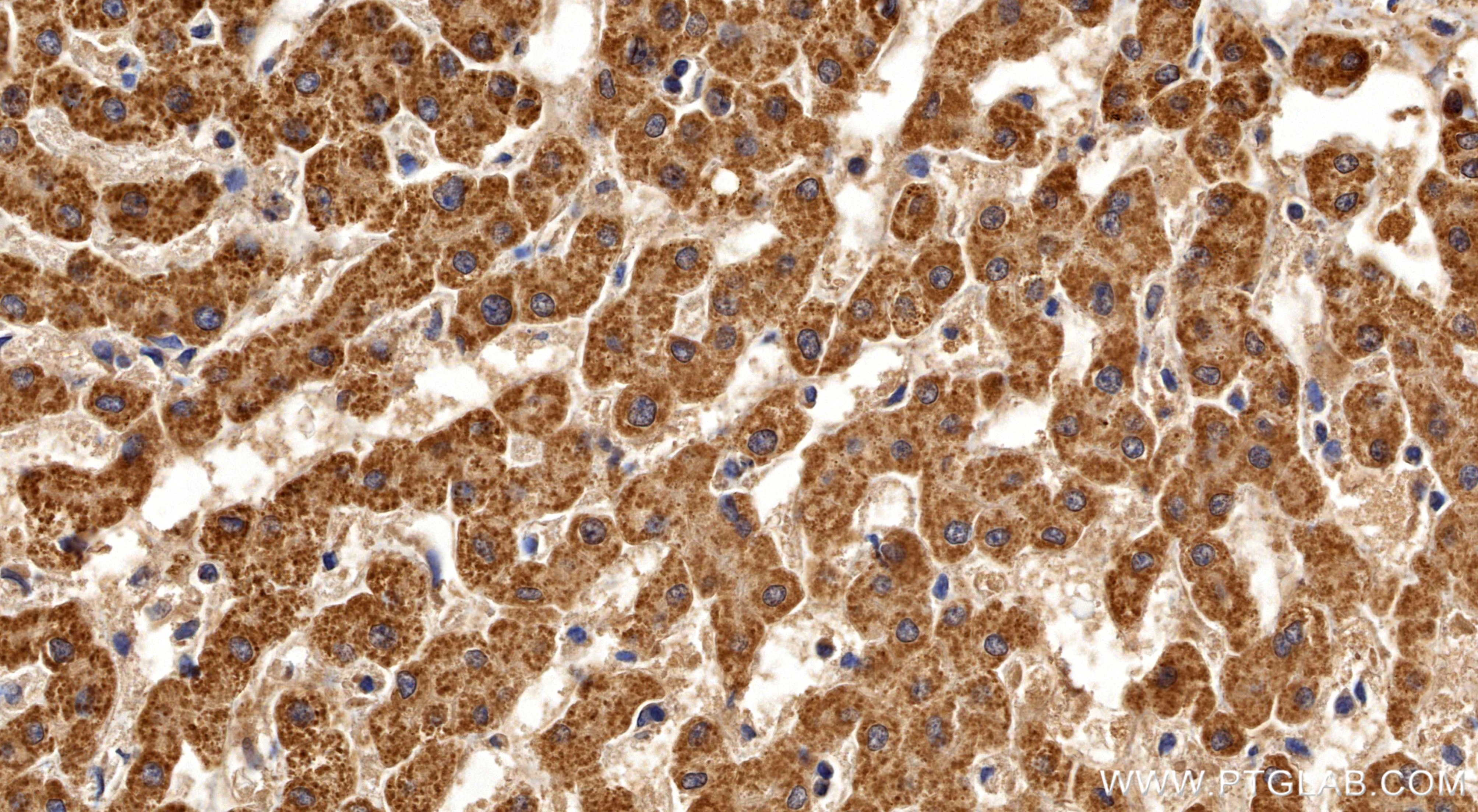 Immunohistochemistry (IHC) staining of human liver tissue using GLDC Recombinant monoclonal antibody (86378-1-RR)