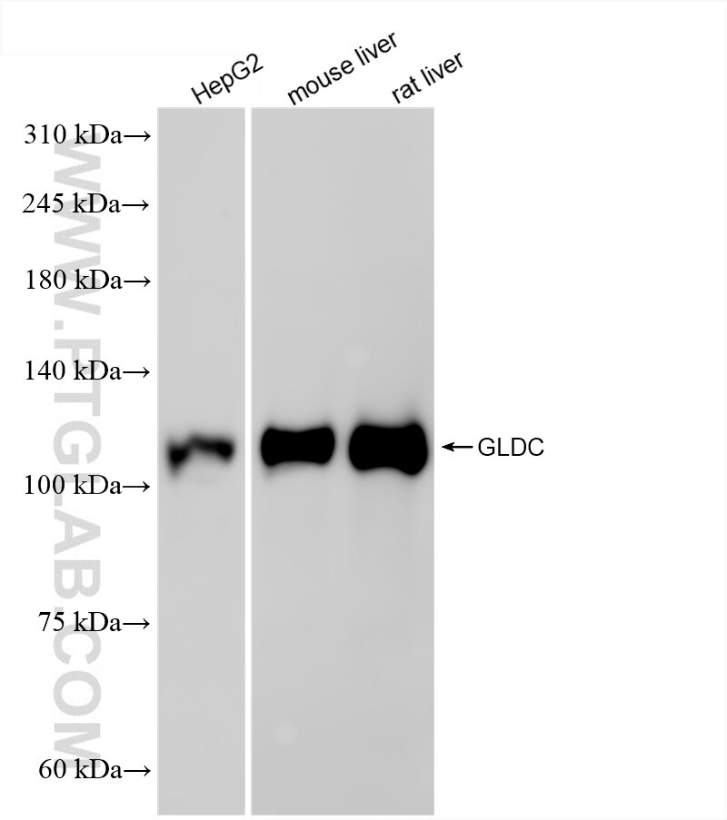 Various lysates were subjected to SDS PAGE followed by western blot with 86378-1-RR (GLDC antibody) at dilution of 1:10000 incubated at room temperature for 1.5 hours. Western Blot (WB) analysis of various lysates using GLDC Recombinant antibody (86378-1-RR)