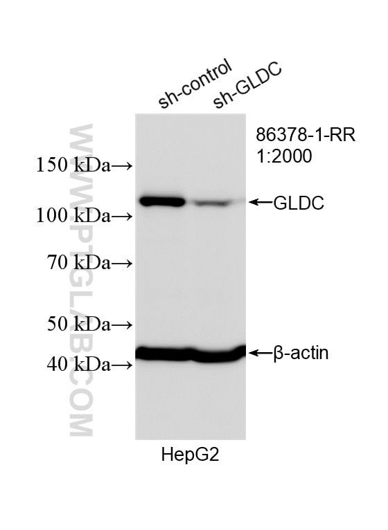 WB analysis of HepG2 using 86378-1-RR Western Blot (WB) analysis of HepG2 cells using GLDC Recombinant monoclonal antibody (86378-1-RR)