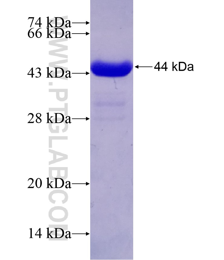 GLDC fusion protein Ag20410 SDS-PAGE