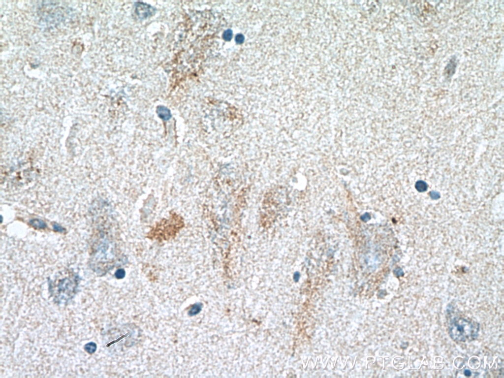 Immunohistochemistry (IHC) staining of human brain tissue using GLDN Polyclonal antibody (26185-1-AP)