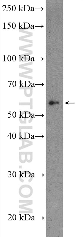 Western Blot (WB) analysis of human placenta tissue using GLDN Polyclonal antibody (26185-1-AP)