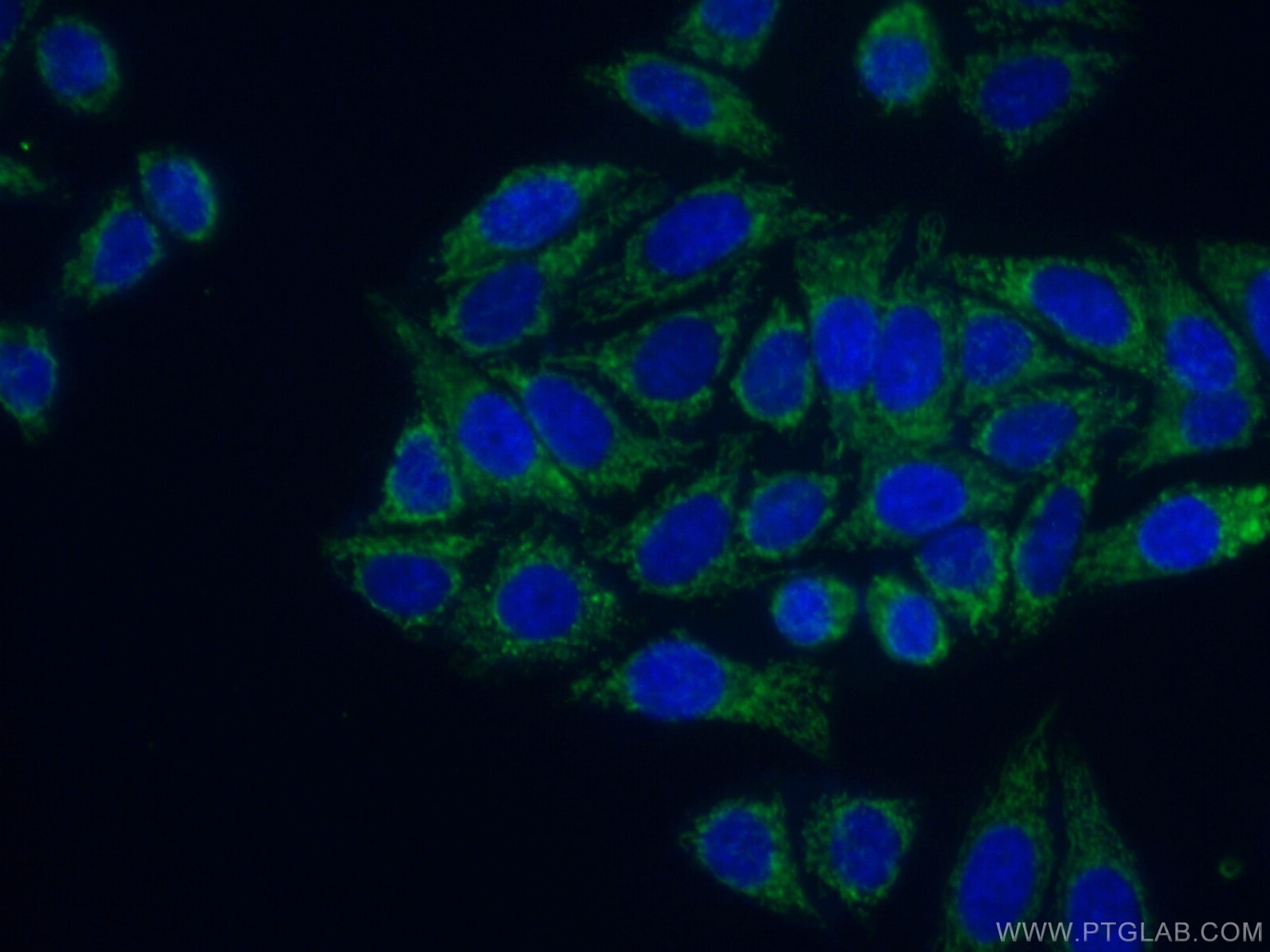 Immunofluorescence (IF) / fluorescent staining of HepG2 cells using GLE1 Polyclonal antibody (26466-1-AP)