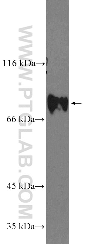Western Blot (WB) analysis of A549 cells using GLE1 Polyclonal antibody (26466-1-AP)