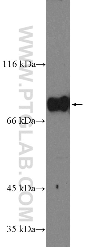 Western Blot (WB) analysis of MCF-7 cells using GLE1 Polyclonal antibody (26466-1-AP)