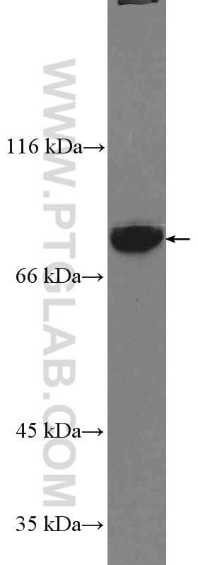 Western Blot (WB) analysis of PC-3 cells using GLE1 Polyclonal antibody (26466-1-AP)