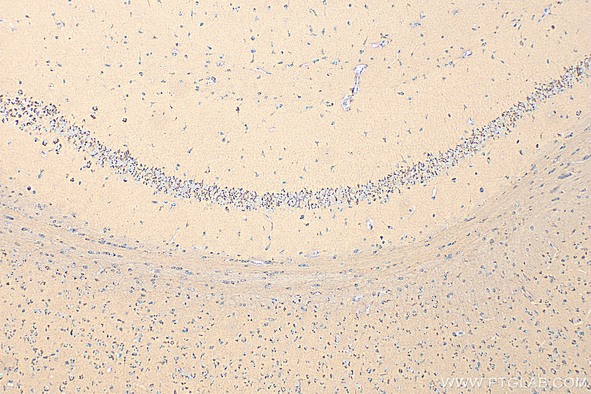 Immunohistochemistry (IHC) staining of mouse brain tissue using GLG1 Polyclonal antibody (34250-1-AP)