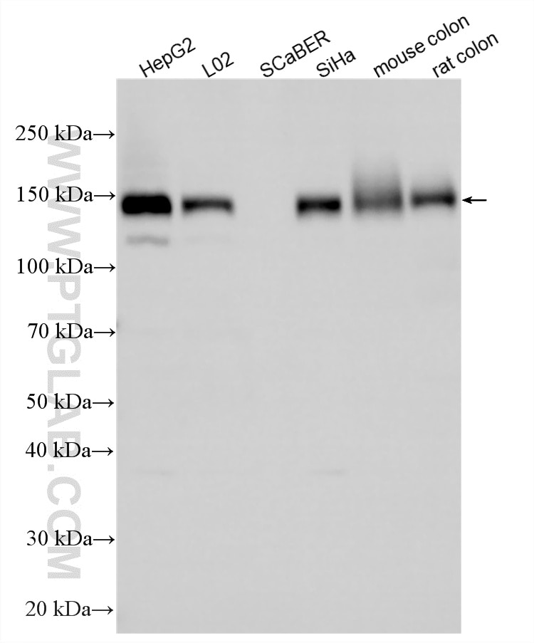 Western Blot (WB) analysis of various lysates using GLG1 Polyclonal antibody (34250-1-AP)