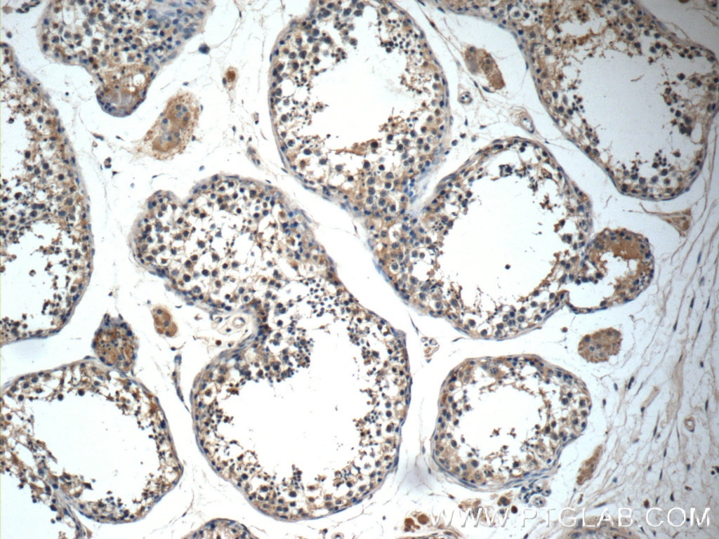 Immunohistochemistry (IHC) staining of human testis tissue using GLI1 Polyclonal antibody (25733-1-AP)