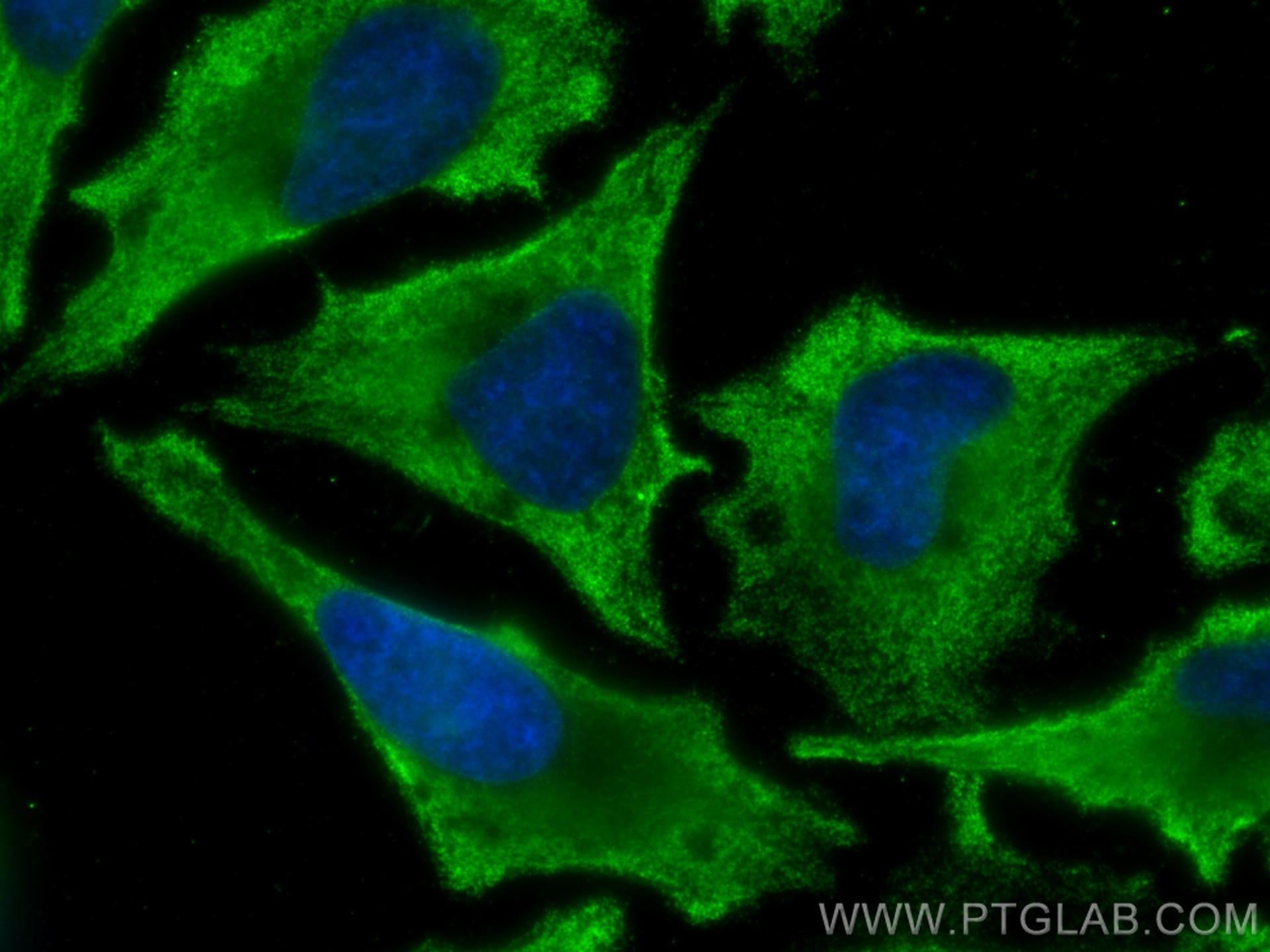Immunofluorescence (IF) / fluorescent staining of HeLa cells using GLI1 Monoclonal antibody (66905-1-Ig)
