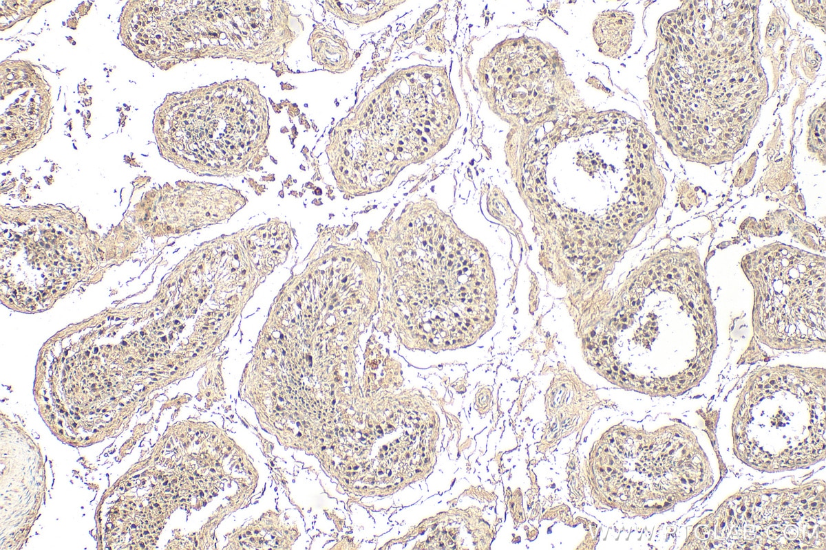 Immunohistochemistry (IHC) staining of human testis tissue using GLI1 Monoclonal antibody (66905-1-Ig)