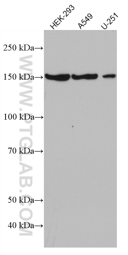 Western Blot (WB) analysis of various lysates using GLI1 Monoclonal antibody (66905-1-Ig)