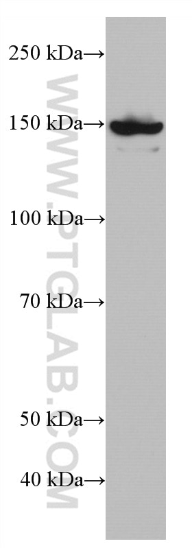 Western Blot (WB) analysis of C6 cells using GLI1 Monoclonal antibody (66905-1-Ig)