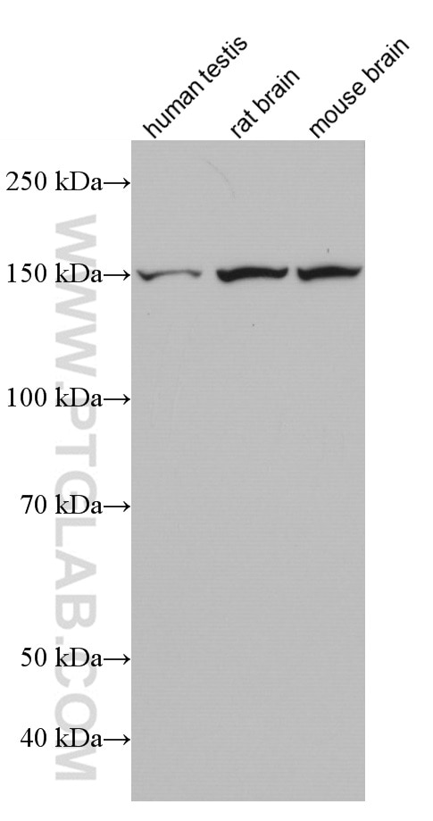 Western Blot (WB) analysis of various lysates using GLI1 Monoclonal antibody (66905-1-Ig)