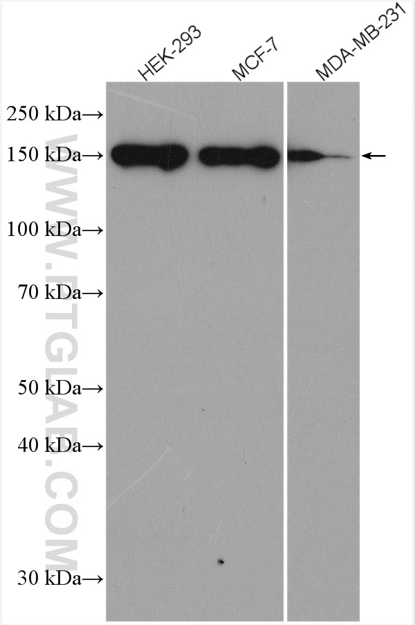 Western Blot (WB) analysis of various lysates using GLI1 Monoclonal antibody (66905-1-Ig)