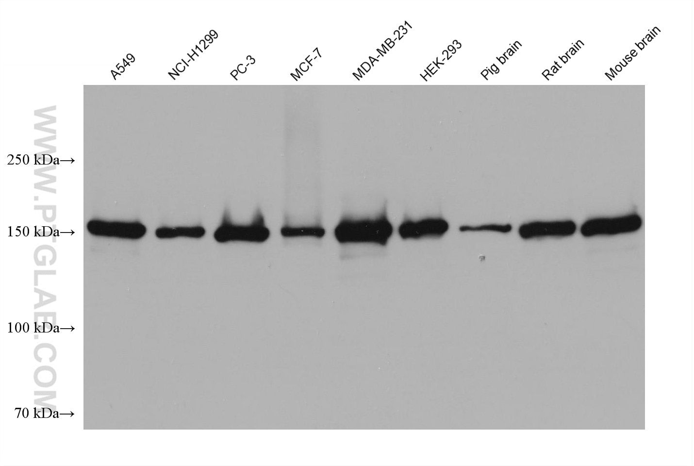 Western Blot (WB) analysis of various lysates using GLI1 Monoclonal antibody (66905-1-Ig)