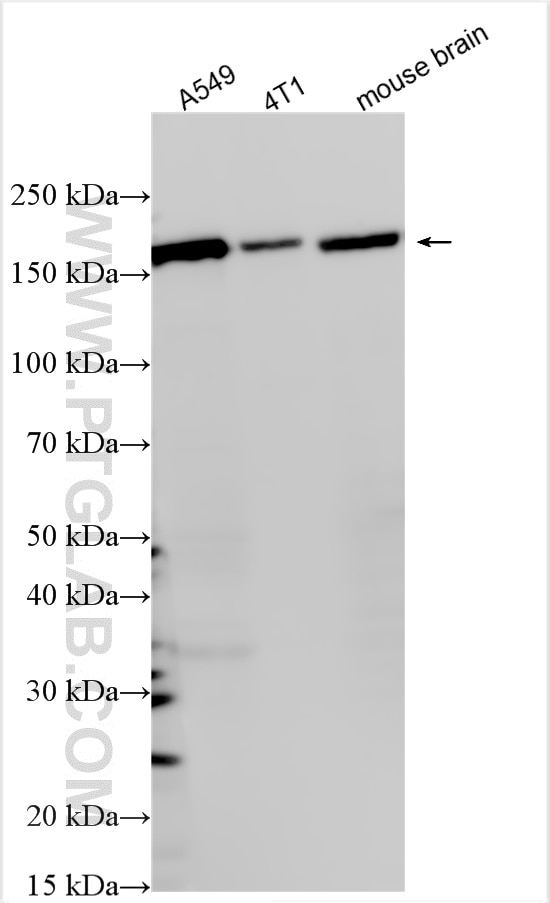 Western Blot (WB) analysis of various lysates using GLI1 Monoclonal antibody (66905-1-Ig)